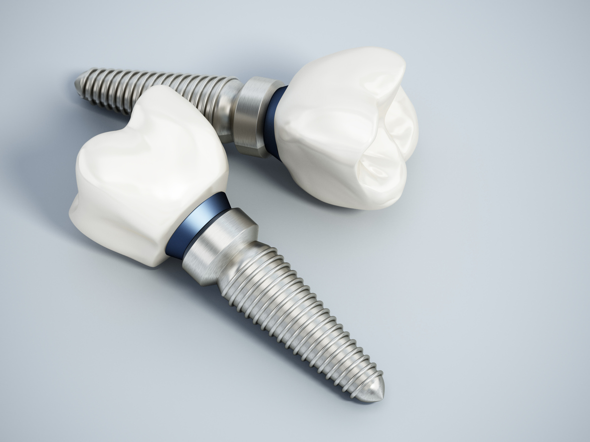 Dental Implants in Middleton, WI