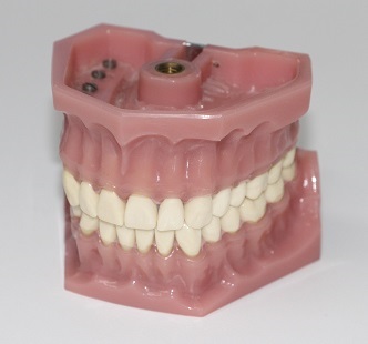 Affordable denture services near Watertown, WI